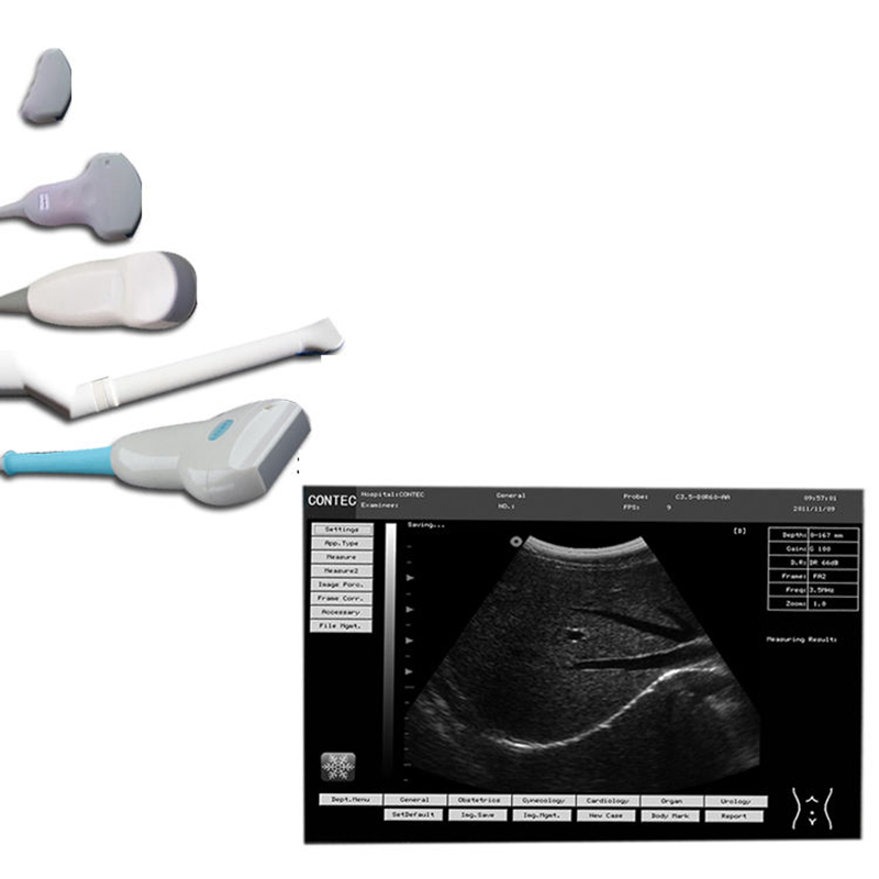 Veterinary Ultrasound Diagnostic System CMS600P2VET