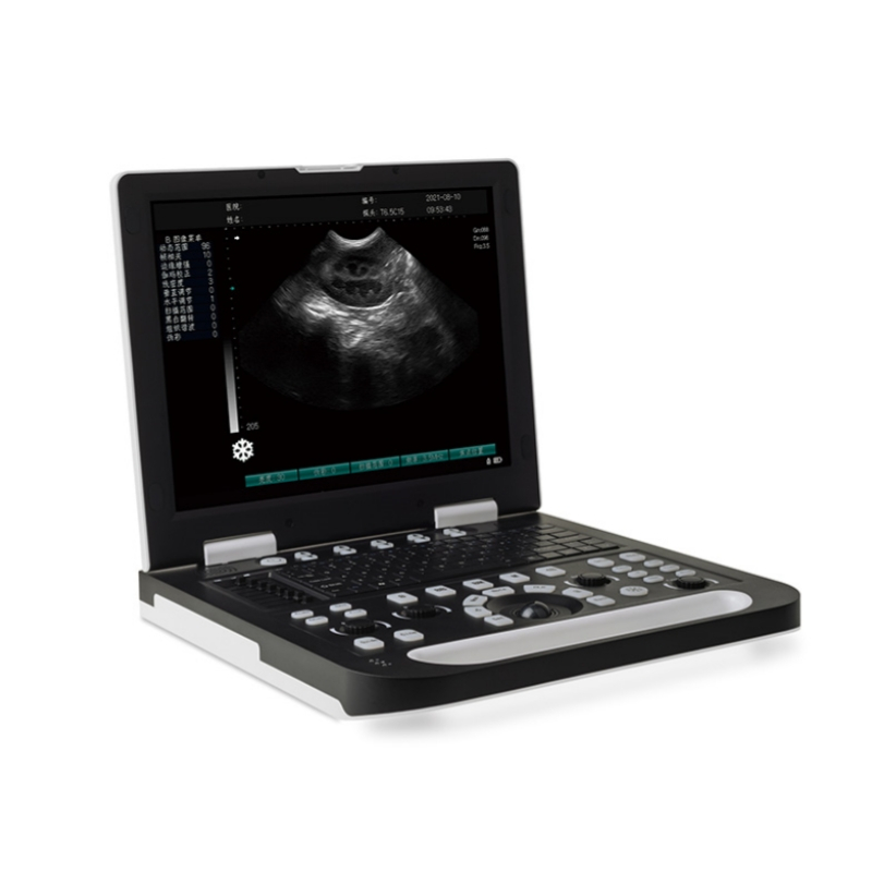 2 Probes Interface 15 Inch Full Digital Veterinary Ultrasound Scanner CBV-RS-N50