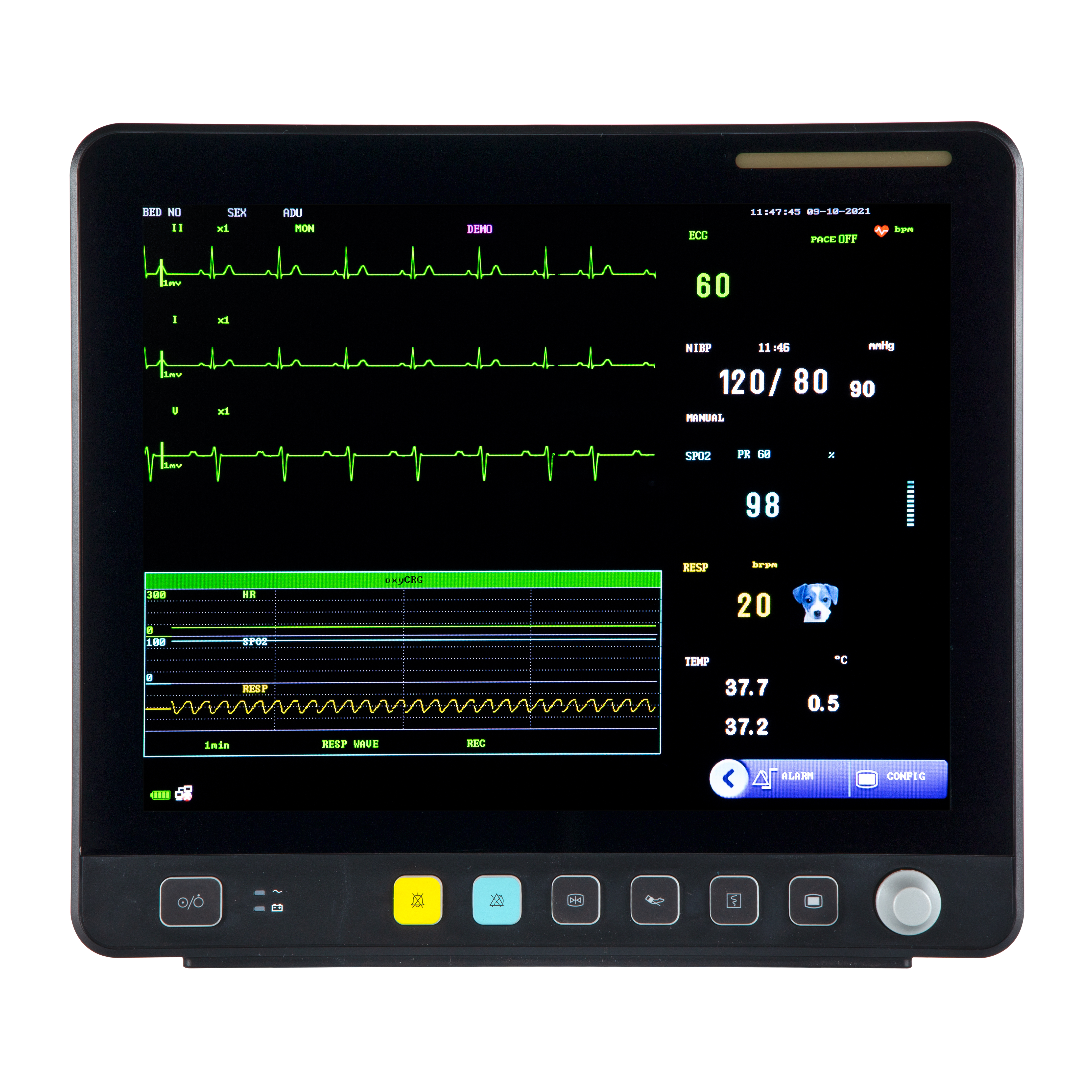 Veterinary Touch Screen Multiparameter ECG Monitor VE15