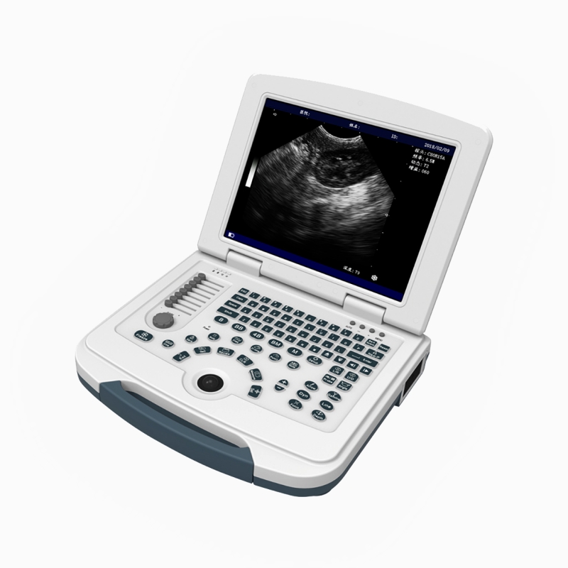 12.1 Inch Portable Laptop Veterinary Ultrasound Scanner for Large Animals CBV-MU10