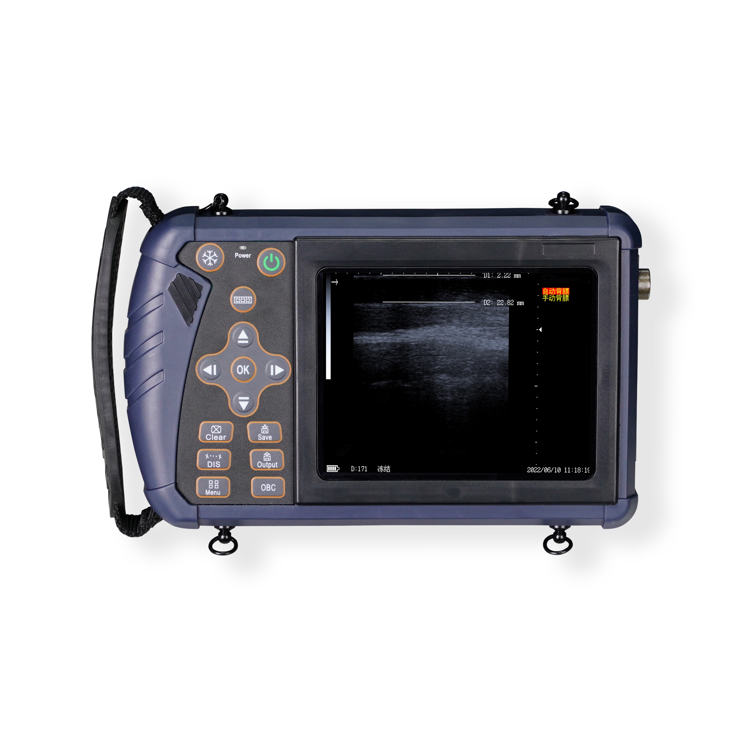 Multifunctional Veterinary Handheld Ultrasound Scanner CBV-S1