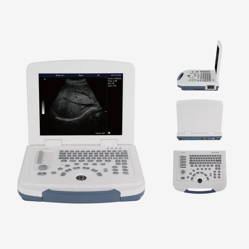 12.1 Inch Portable Laptop Veterinary Ultrasound Scanner for Large Animals CBV-MU10